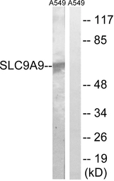 Anti-SLC9A9 antibody used in Western Blot (WB). GTX87863