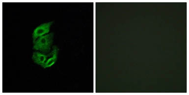 Anti-STA13 antibody used in Immunocytochemistry/ Immunofluorescence (ICC/IF). GTX87867