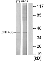 Anti-ZNF435 antibody used in Western Blot (WB). GTX87871