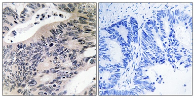 Anti-ACSS1 antibody used in IHC (Paraffin sections) (IHC-P). GTX87873
