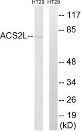 Anti-ACSS1 antibody used in Western Blot (WB). GTX87873