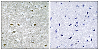 Anti-URB1 antibody used in IHC (Paraffin sections) (IHC-P). GTX87874