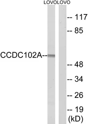 Anti-CCDC102A antibody used in Western Blot (WB). GTX87877