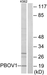 Anti-PBOV1 antibody used in Western Blot (WB). GTX87880