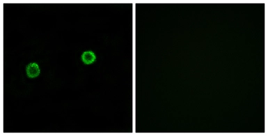 Anti-ACOT4 antibody used in Immunocytochemistry/ Immunofluorescence (ICC/IF). GTX87881
