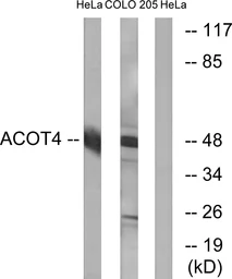 Anti-ACOT4 antibody used in Western Blot (WB). GTX87881