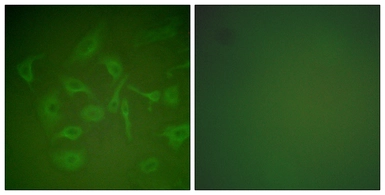 Anti-Mammaglobin A antibody used in Immunocytochemistry/ Immunofluorescence (ICC/IF). GTX87883