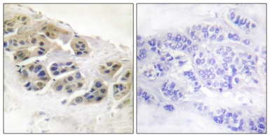 Anti-Mammaglobin A antibody used in IHC (Paraffin sections) (IHC-P). GTX87883