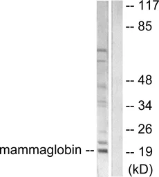 Anti-Mammaglobin A antibody used in Western Blot (WB). GTX87883
