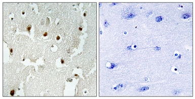 Anti-TReP132 antibody used in IHC (Paraffin sections) (IHC-P). GTX87884