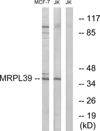 Anti-MRPL39 antibody used in Western Blot (WB). GTX87886