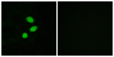 Anti-TSHZ2 antibody used in Immunocytochemistry/ Immunofluorescence (ICC/IF). GTX87889