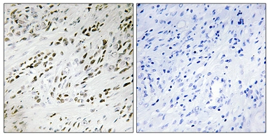Anti-TSHZ2 antibody used in IHC (Paraffin sections) (IHC-P). GTX87889