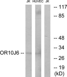 Anti-OR10J6 antibody used in Western Blot (WB). GTX87892