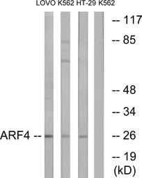 Anti-ARF4 antibody used in Western Blot (WB). GTX87894