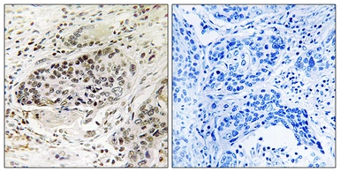 Anti-APBA2 antibody used in IHC (Paraffin sections) (IHC-P). GTX87895