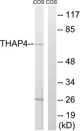 Anti-THAP4 antibody used in Western Blot (WB). GTX87897