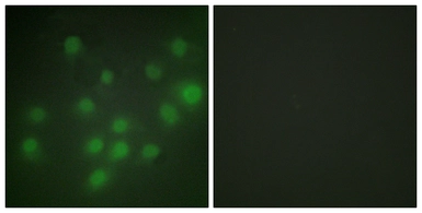 Anti-HKR1 antibody used in Immunocytochemistry/ Immunofluorescence (ICC/IF). GTX87898