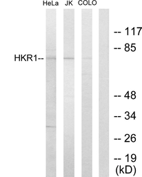 Anti-HKR1 antibody used in Western Blot (WB). GTX87898