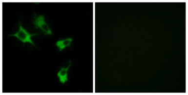 Anti-MAST4 antibody used in Immunocytochemistry/ Immunofluorescence (ICC/IF). GTX87899
