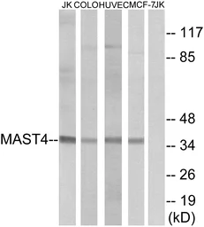 Anti-MAST4 antibody used in Western Blot (WB). GTX87899