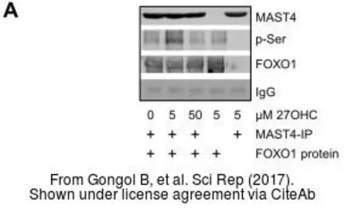 Anti-MAST4 antibody used in Western Blot and Immunoprecipitation (WB IP). GTX87899
