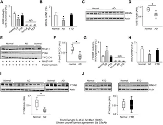 Anti-MAST4 antibody used in Western Blot and Immunoprecipitation (WB IP). GTX87899