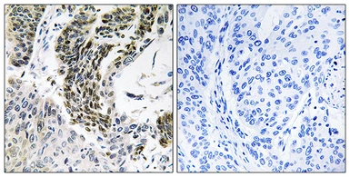 Anti-RREB1 antibody used in IHC (Paraffin sections) (IHC-P). GTX87900