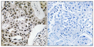 Anti-ZMYM4 antibody used in IHC (Paraffin sections) (IHC-P). GTX87903