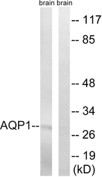 Anti-Aquaporin 1 antibody used in Western Blot (WB). GTX87904