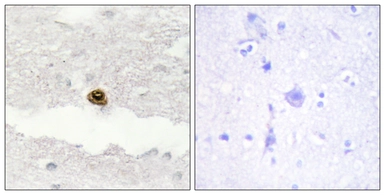 Anti-DGKZ antibody used in IHC (Paraffin sections) (IHC-P). GTX87908