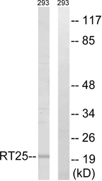 Anti-MRPS25 antibody used in Western Blot (WB). GTX87909