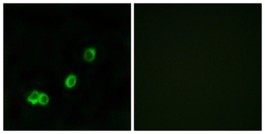 Anti-ACOT1 antibody used in Immunocytochemistry/ Immunofluorescence (ICC/IF). GTX87911