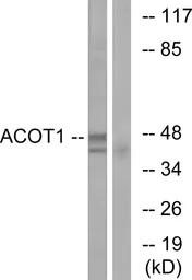 Anti-ACOT1 antibody used in Western Blot (WB). GTX87911