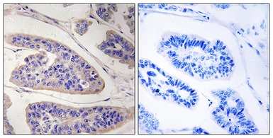 Anti-Mena antibody used in IHC (Paraffin sections) (IHC-P). GTX87912