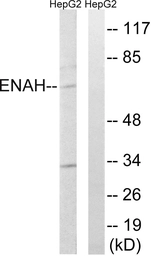 Anti-Mena antibody used in Western Blot (WB). GTX87912