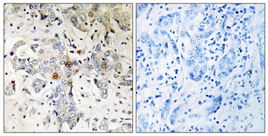 Anti-ZCCHC17 antibody used in IHC (Paraffin sections) (IHC-P). GTX87913