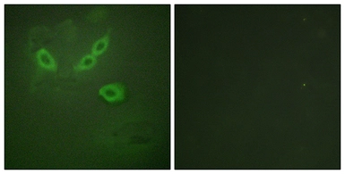Anti-TUSC5 antibody used in Immunocytochemistry/ Immunofluorescence (ICC/IF). GTX87917