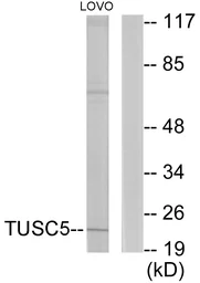 Anti-TUSC5 antibody used in Western Blot (WB). GTX87917