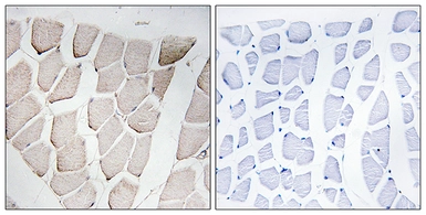 Anti-MYOM1 antibody used in IHC (Paraffin sections) (IHC-P). GTX87922