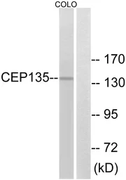Anti-CEP135 antibody used in Western Blot (WB). GTX87924