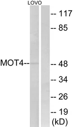 Anti-MCT4 antibody used in Western Blot (WB). GTX87926