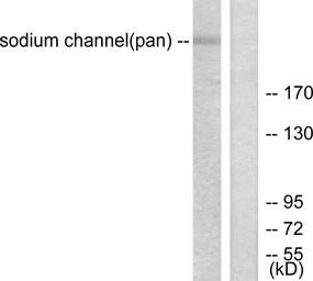 Anti-Sodium Channel-pan antibody used in Western Blot (WB). GTX87930