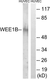 Anti-WEE2 antibody used in Western Blot (WB). GTX87931