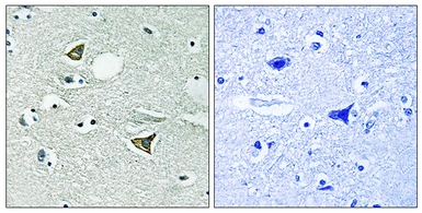 Anti-Girdin antibody used in IHC (Paraffin sections) (IHC-P). GTX87941