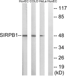 Anti-SIRP beta 1 antibody used in Western Blot (WB). GTX87943