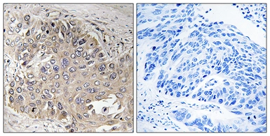 Anti-SPTBN5 antibody used in IHC (Paraffin sections) (IHC-P). GTX87945