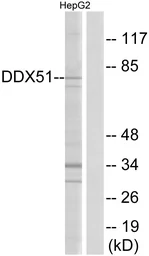 Anti-DDX51 antibody used in Western Blot (WB). GTX87946