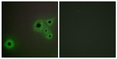 Anti-MED23 antibody used in Immunocytochemistry/ Immunofluorescence (ICC/IF). GTX87948
