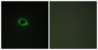Anti-TENS3 antibody used in Immunocytochemistry/ Immunofluorescence (ICC/IF). GTX87949